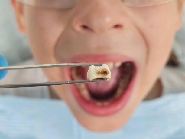 Best Broken Tooth Emergency  in Mayfield Heights, OH